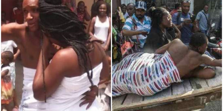 Penis Captivus (captive penis)